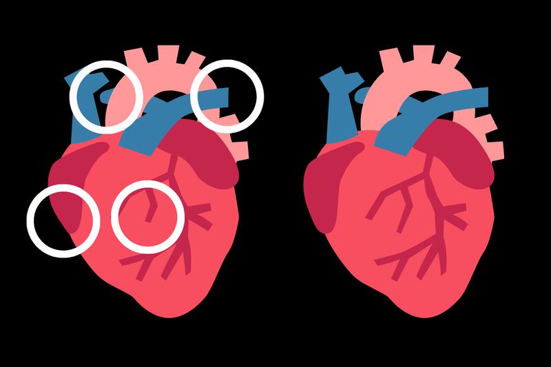 En este test visual hay dos corazones que parecen iguales, pero que tienen cuatro diferencias entre ellos.